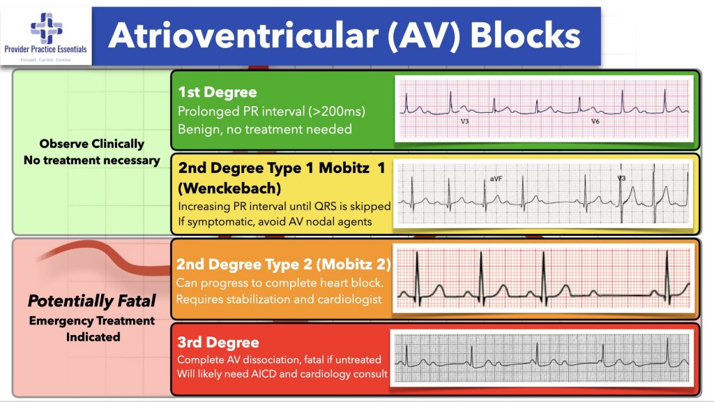 Normal EKG Variants