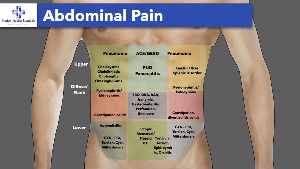 Abdominal Pain by location